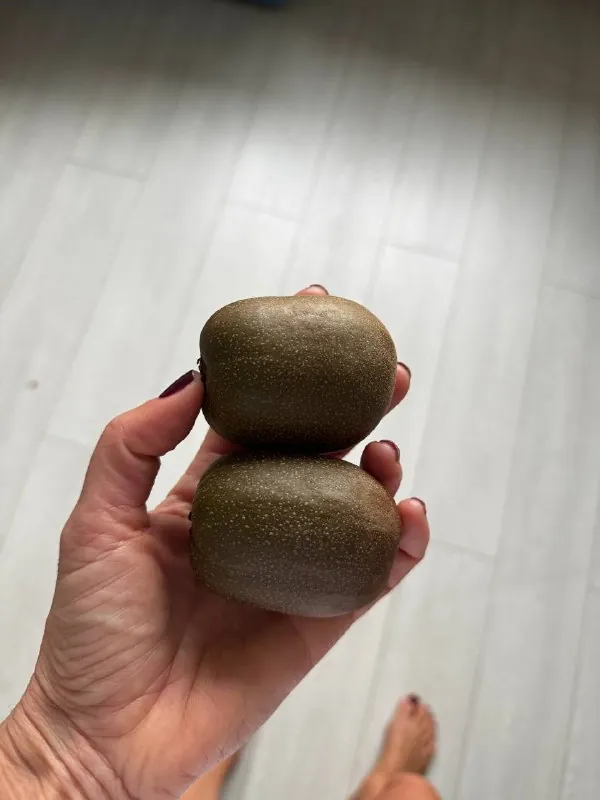 🥝 Киви против бессонницы: что говорят два ключевых исследования?