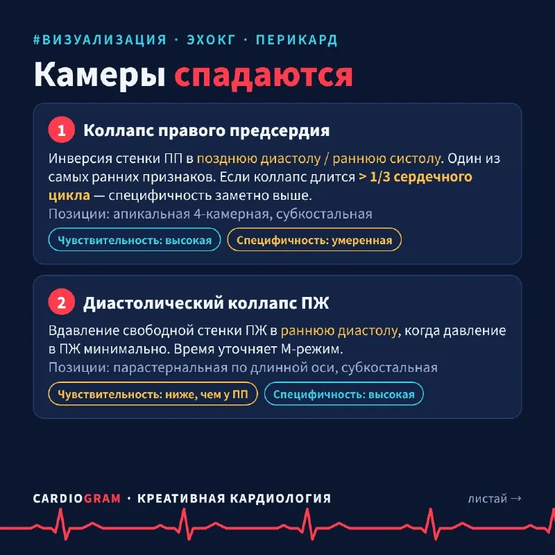 🫀 Тампонада сердца: 5 эхо-признаков за одну карусель