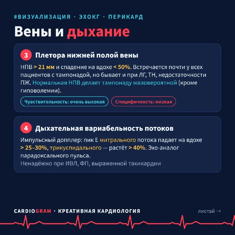 🫀 Тампонада сердца: 5 эхо-признаков за одну карусель