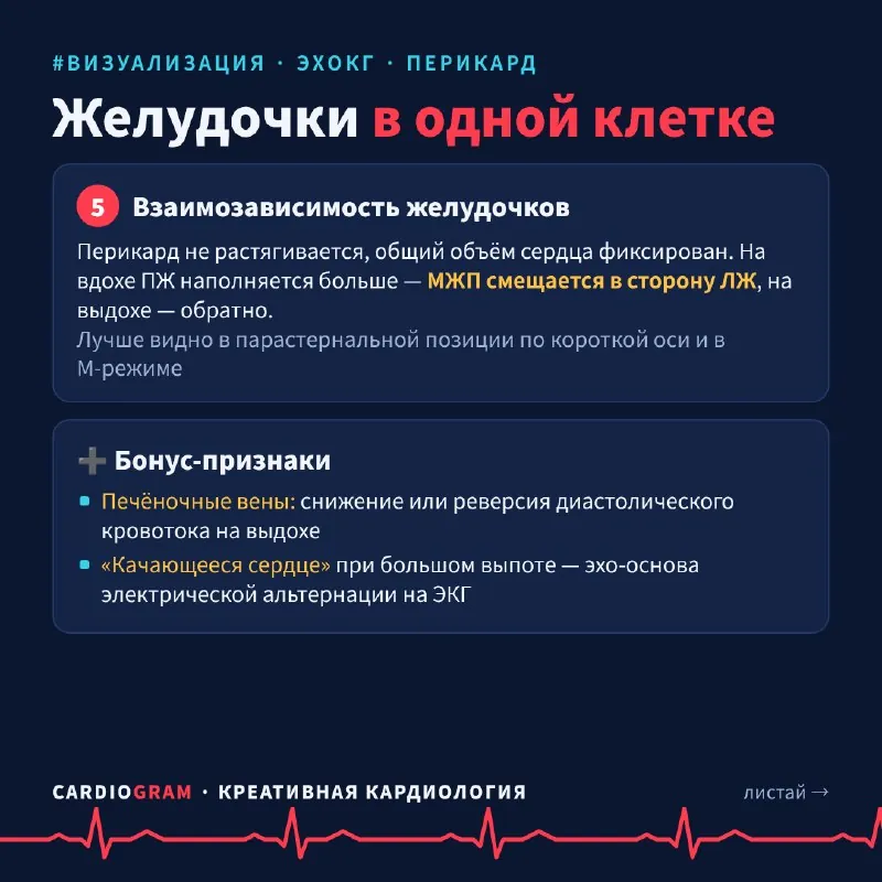 🫀 Тампонада сердца: 5 эхо-признаков за одну карусель