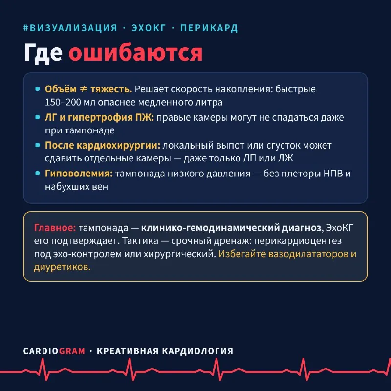 🫀 Тампонада сердца: 5 эхо-признаков за одну карусель