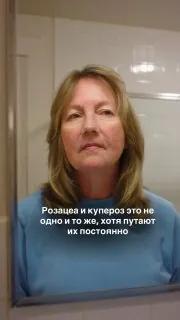 Приходит женщина, возраст плюс-минус пятьдесят: «Назначьте мне, пожалуйста, какой-нибудь крем, не нравятся сосуды на…