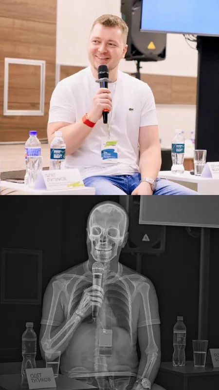 Рентген в ChatGPT 😯