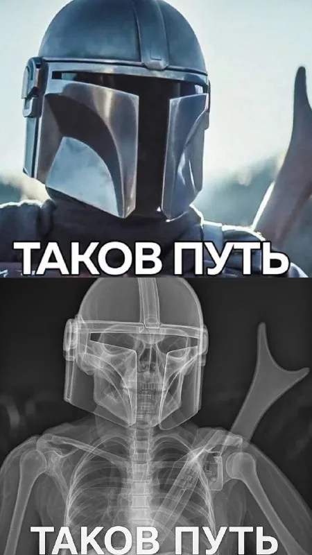 Рентген в ChatGPT 😯