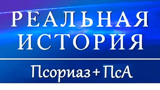 Моя история, ошибки и замечания, ч.1