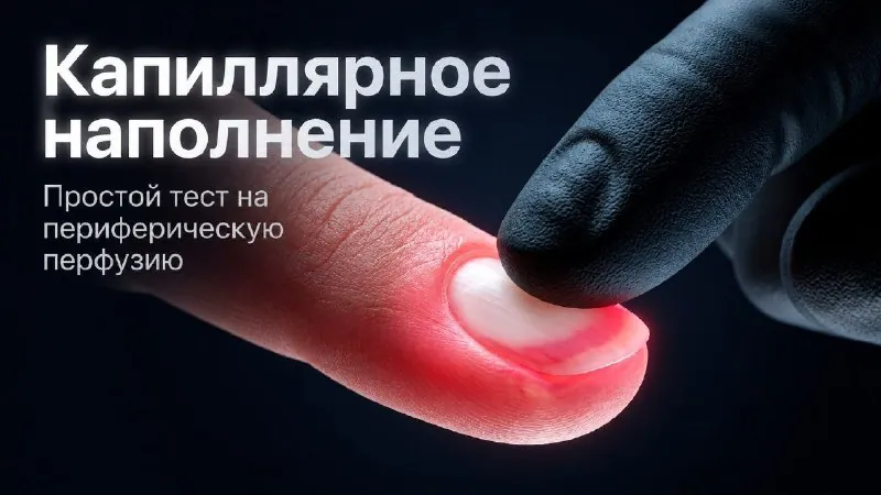 🩸 Капиллярное наполнение: простой и быстрый тест на периферическую перфузию…