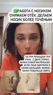 💅 Вакуумный уход